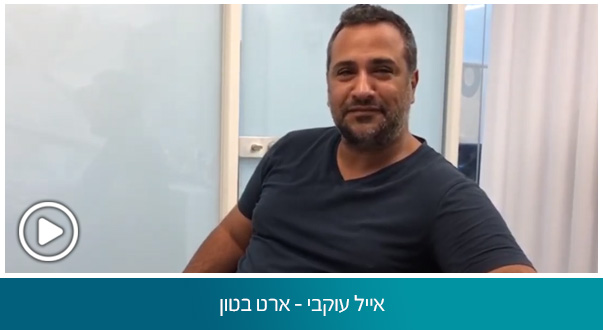 אייל עוקבי - ארט בטון